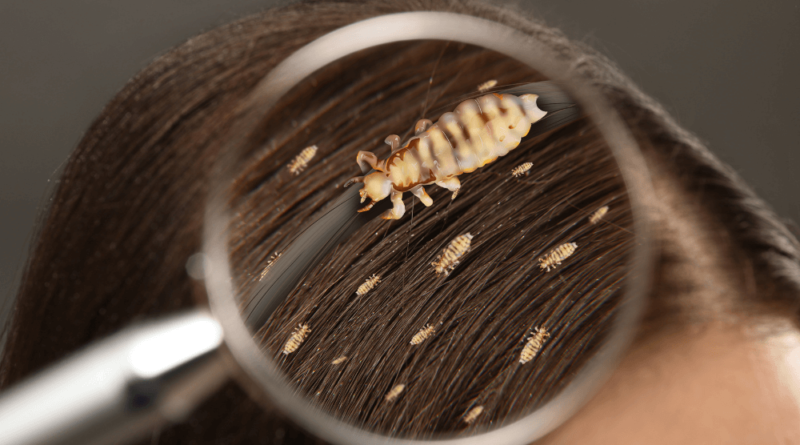 Do Lice Like Dirty Hair