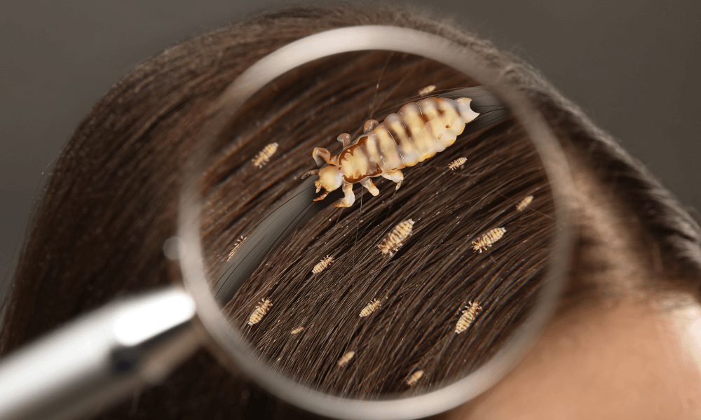 Do Lice Like Dirty Hair